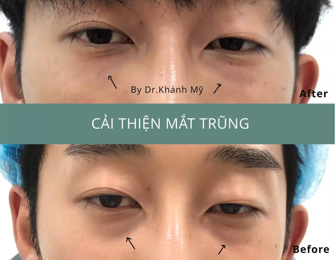 Bí Quyết Chọn Dáng Chân Mày Điêu Khắc Phù Hợp Với Từng Khuôn Mặt