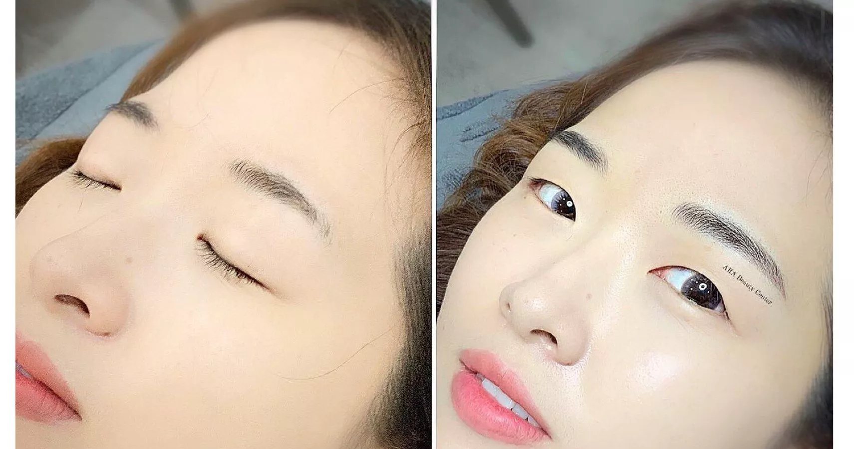 Sửa Chân Mày Trổ Xanh Trổ Đỏ Ở Đâu Uy Tín Tại Quận 3 TP.HCM?